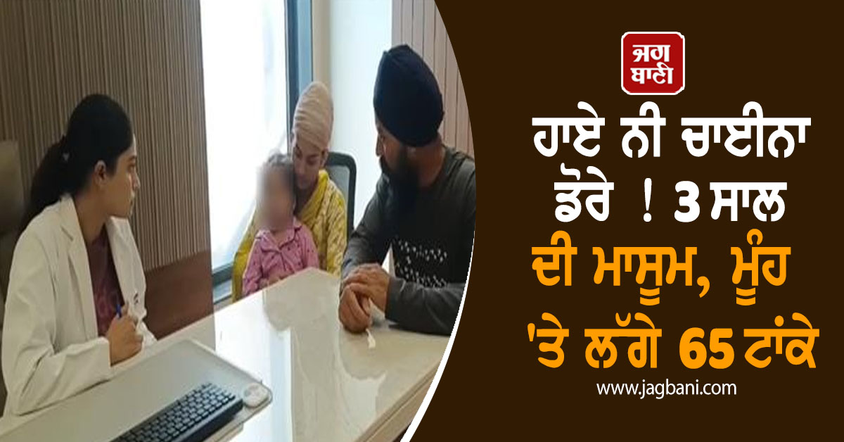 ਹਾਏ ਨੀ ਚਾਈਨਾ ਡੋਰੇ ! 3 ਸਾਲ ਦੀ ਮਾਸੂਮ, ਮੂੰਹ 'ਤੇ ਲੱਗੇ 65 ਟਾਂਕੇ