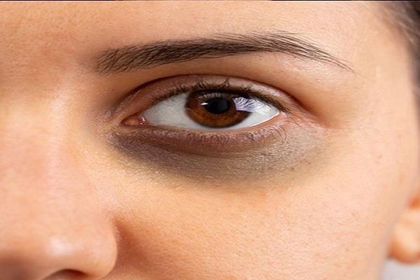 vitamins  sleep  eyes  dark circles