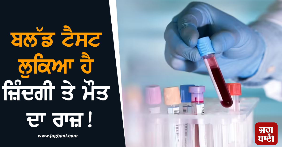 ਬਲੱਡ ਟੈਸਟ 'ਚ ਲੁਕਿਆ ਹੈ ਜ਼ਿੰਦਗੀ ਤੇ ਮੌਤ ਦਾ ਰਾਜ਼! ਰਿਸਰਚ 'ਚ ਹੋਇਆ ਹੈਰਾਨੀਜਨਕ ਖ਼ੁਲਾਸਾ