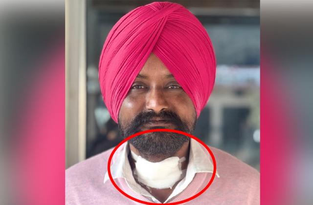 ਪਾਬੰਦੀਸ਼ੁਦਾ ਪਲਾਸਟਿਕ ਡੋਰ ਦੀ ਲਪੇਟ ’ਚ ਆਉਣ ਕਰ ਕੇ ਨੌਜਵਾਨ ਦੇ ਗੱਲ ’ਤੇ ਲੱਗਿਆ ਕੱਟ