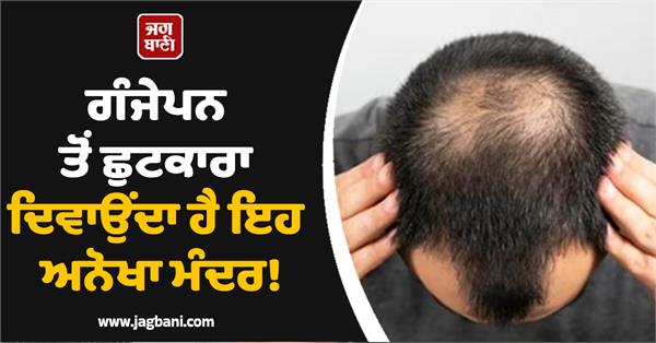 baldness  temple  devotees  history