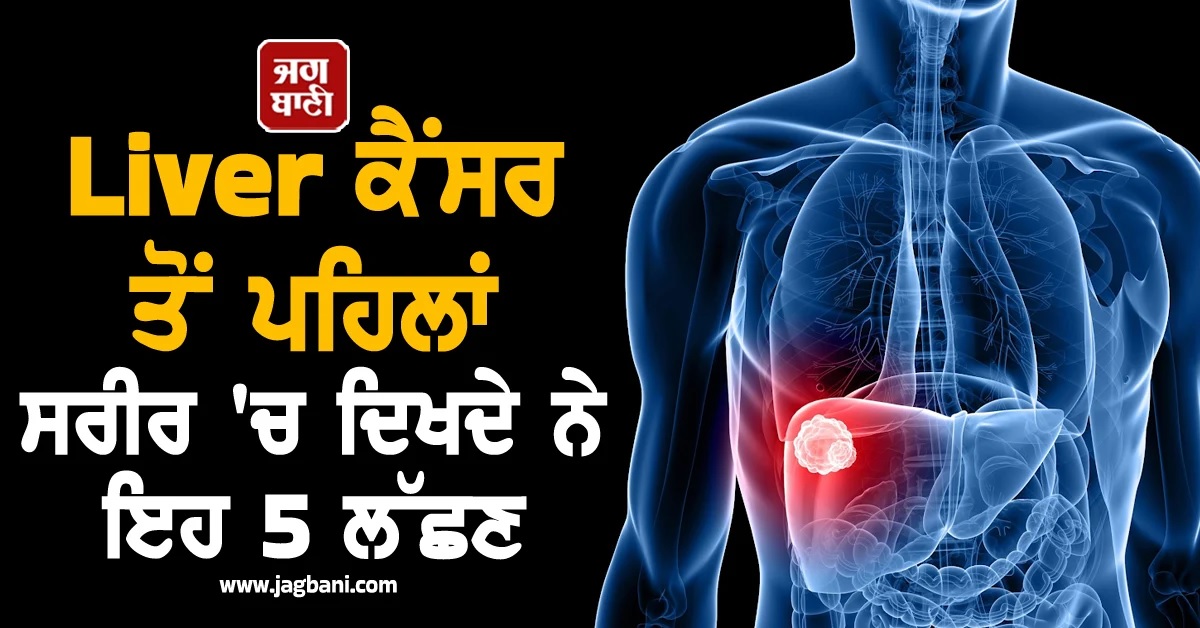 Liver ਕੈਂਸਰ ਤੋਂ ਪਹਿਲਾਂ ਸਰੀਰ ''ਚ ਦਿਖਦੇ ਨੇ ਇਹ 5 ਲੱਛਣ, ਸਮੇਂ ਸਿਰ ਪਛਾਣ ਨਾਲ ਬਚ ਸਕਦੀ ਹੈ ਜਾਨ