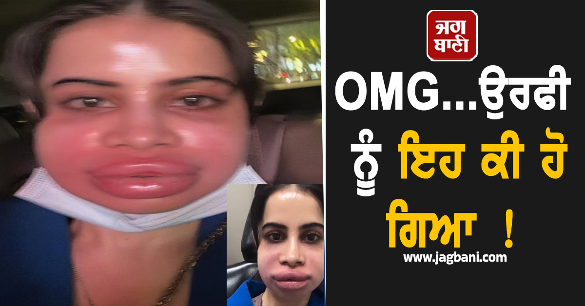 OMG...ਉਰਫੀ ਨੂੰ ਇਹ ਕੀ ਹੋ ਗਿਆ ! ਵਾਇਰਲ ਤਸਵੀਰਾਂ ਨੇ ਵਧਾਈ ਫੈਨਜ਼ ਦੀ ਚਿੰਤਾ