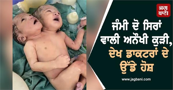 woman birth baby girl 2 head doctors shocked