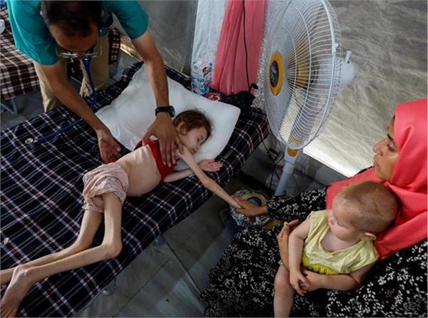 israel induced starvation grows in gaza more children die