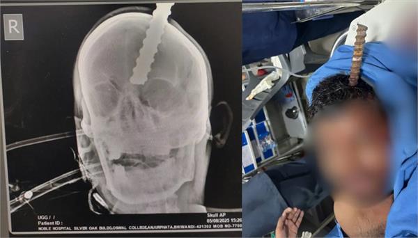 iron rod goes through youth head