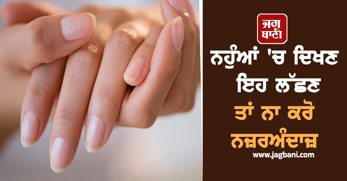 ਨਹੁੰਆਂ ''ਚ ਦਿਖਣ ਇਹ ਲੱਛਣ ਤਾਂ ਨਾ ਕਰੋ ਨਜ਼ਰਅੰਦਾਜ਼, ਹੋ ਸਕਦੀ ਹੈ ਗੰਭੀਰ ਬੀਮਾਰੀ
