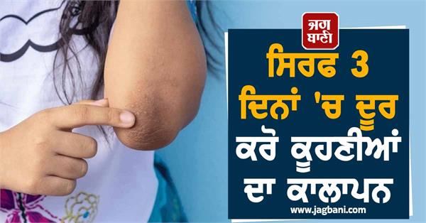 elbow blackness home remedy