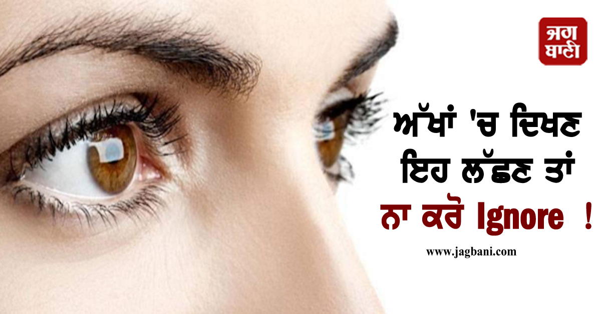 ਅੱਖਾਂ ''ਚ ਦਿਖਣ ਇਹ ਲੱਛਣ ਤਾਂ ਨਾ ਕਰੋ Ignore ! ਗੰਭੀਰ ਬੀਮਾਰੀ ਦਾ ਹੋ ਸਕਦੈ ਸੰਕੇਤ