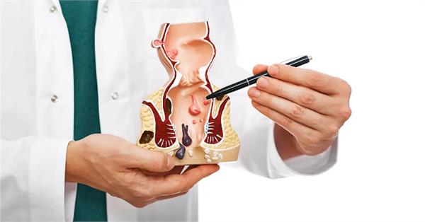 fistula connects two parts of body  know the symptoms and modern treatment