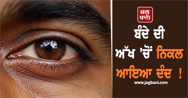 eye tooth doctor surgery