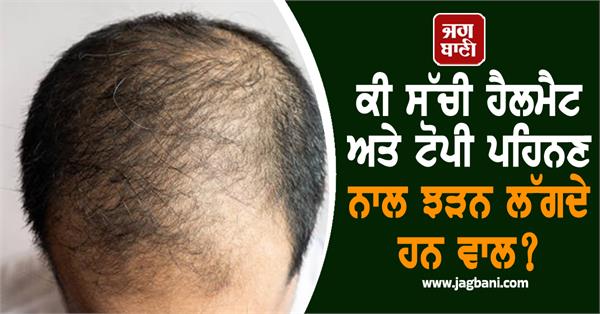 helmet hat hair loss