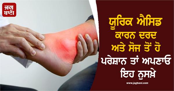uric acid pain home remedies