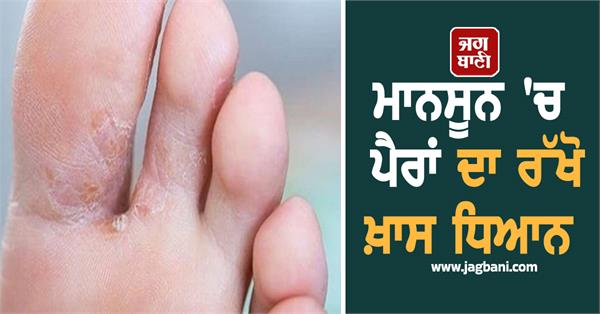 monsoon foot fungal infection remedies
