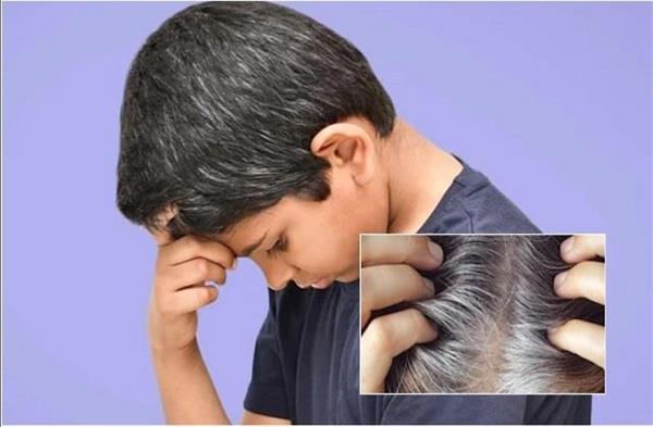 childhood white hair parents doctor