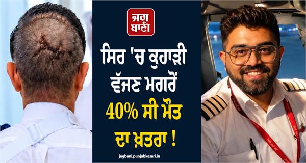 smit machchhar surgery revealed