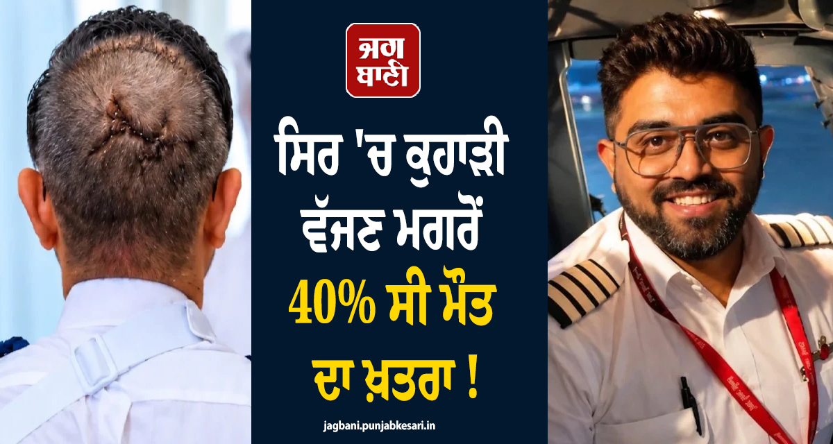 ਸਿਰ ''ਚ ਕੁਹਾੜੀ ਵੱਜਣ ਮਗਰੋਂ 40% ਸੀ ਮੌਤ ਦਾ ਖ਼ਤਰਾ ! ਡਾਕਟਰਾਂ ਨੇ ਕੈਪਟਨ ਮਛਾਰ ਬਾਰੇ ਕੀਤਾ ਵੱਡਾ ਖੁਲਾਸਾ