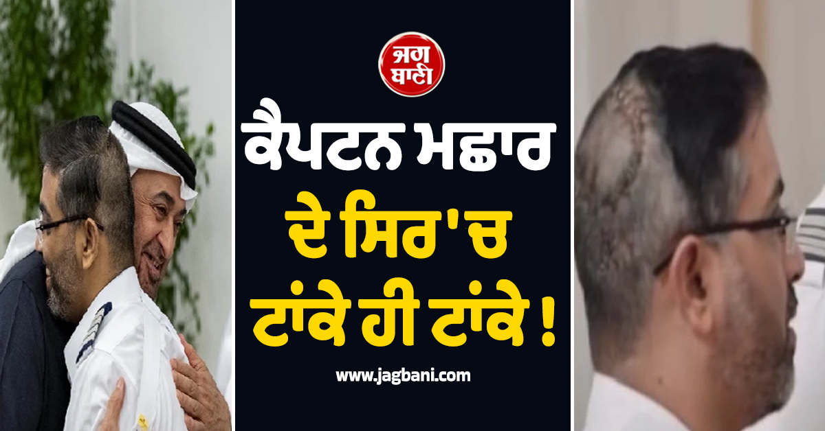 ਕੈਪਟਨ ਮਛਾਰ ਦੇ ਸਿਰ 'ਚ ਟਾਂਕੇ ਹੀ ਟਾਂਕੇ ! ਭਾਰਤੀ ਪਾਇਲਟ ਦੀਆਂ ਤਸਵੀਰਾਂ ਆਈਆਂ ਸਾਹਮਣੇ