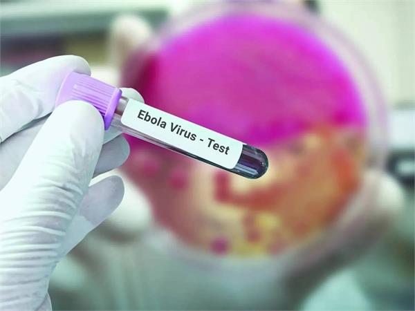 ebola virus