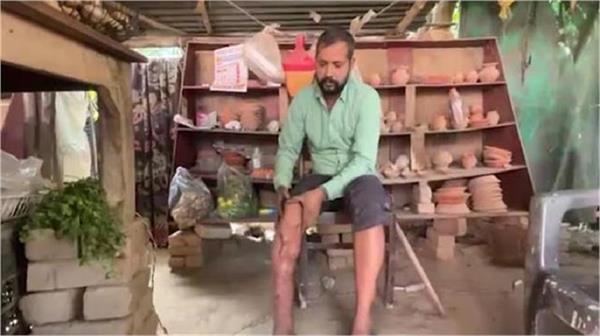 10 operations 21 lakh debt man disabled