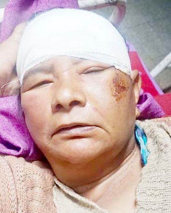 neighbors pelt woman with bricks after argument