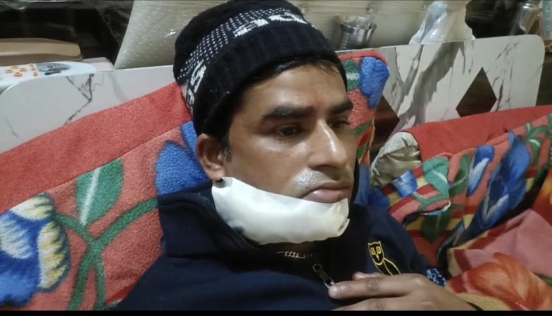 ਦੀਨਾਨਗਰ ਵਿਖੇ ਚਾਈਨਾ ਡੋਰ ਦੀ ਲਪੇਟ ''ਚ ਆਇਆ ਨੌਜਵਾਨ, 30 ਤੋਂ 35 ਲੱਗੇ ਟਾਕੇ