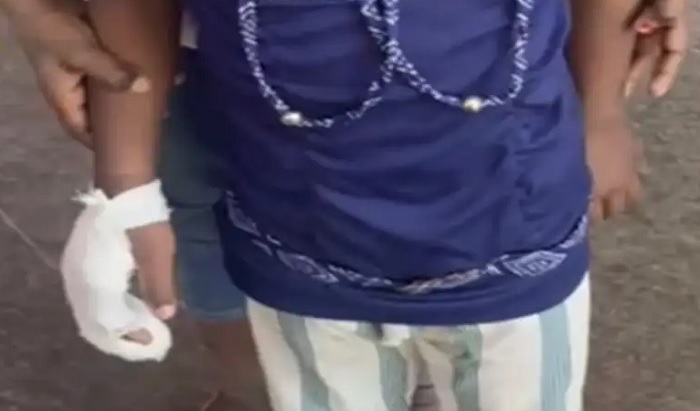 ਸਰਕਾਰੀ ਸਕੂਲ ''ਚ ਵੱਡਾ ਹਾਦਸਾ ! ਲੰਚ ਲਈ ਲਾਈਨ ''ਚ ਲੱਗੀ ਕੁੜੀ ਦੀਆਂ ਵੱਢੀਆਂ ਗਈਆਂ 2 ਉਂਗਲਾਂ