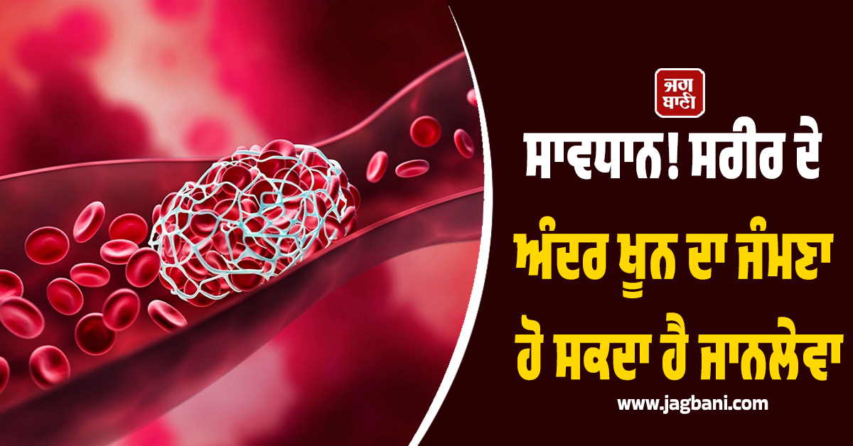 ਸਾਵਧਾਨ! ਸਰੀਰ ਦੇ ਅੰਦਰ ਖੂਨ ਦਾ ਜੰਮਣਾ ਹੋ ਸਕਦਾ ਹੈ ਜਾਨਲੇਵਾ, ਜਾਣੋ ਲੱਛਣ ਅਤੇ ਬਚਾਅ ਦੇ ਤਰੀਕੇ
