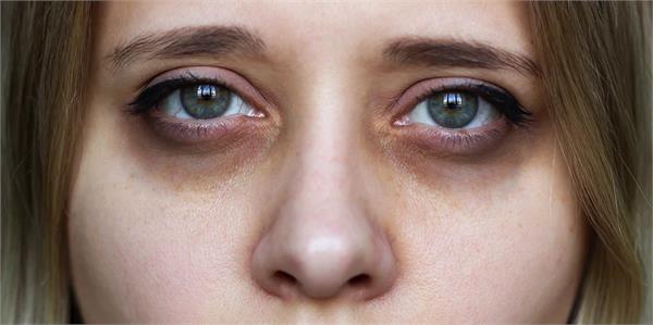 follow these tips to get rid of dark circles