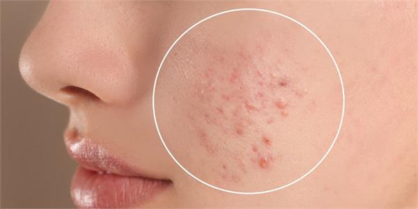 want to bring a natural glow to your face 