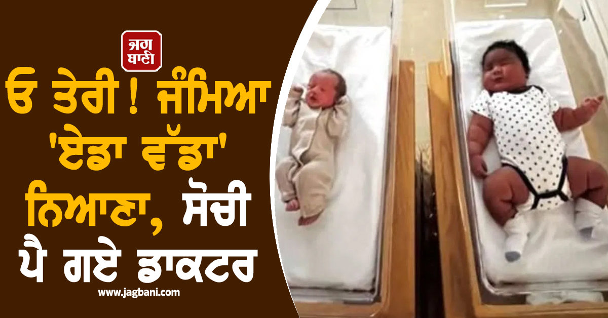 ਓ ਤੇਰੀ! ਜੰਮਿਆ 'ਏਡਾ ਵੱਡਾ' ਨਿਆਣਾ, ਸੋਚੀ ਪੈ ਗਏ ਡਾਕਟਰ, ਪਰਿਵਾਰ ਦੇ ਵੀ ਉੱਡੇ ਹੋਸ਼