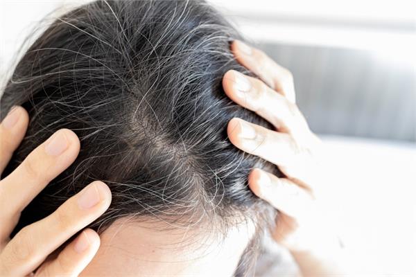 greying hair back to black with these home remedies
