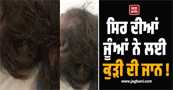 head lice took the girl  s life 