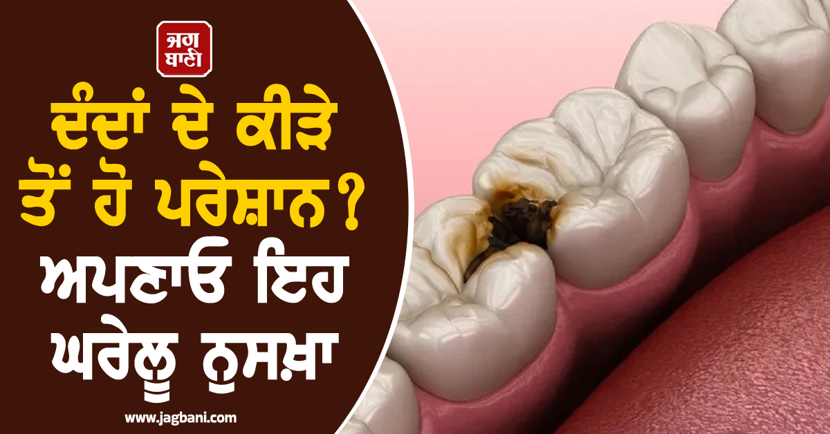 ਦੰਦਾਂ ਦੇ ਕੀੜੇ ਤੋਂ ਹੋ ਪਰੇਸ਼ਾਨ? ਅਪਣਾਓ ਇਹ ਘਰੇਲੂ ਨੁਸਖ਼ਾ, 48 ਘੰਟਿਆਂ 'ਚ ਮਿਲੇਗੀ ਰਾਹਤ