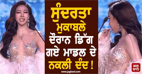 during the ramp walk the fake teeth of the slipped