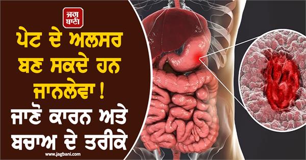 stomach ulcers can become life threatening 