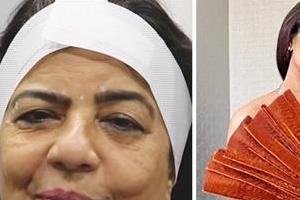 priyanka chopra  s mother  s botox treatment