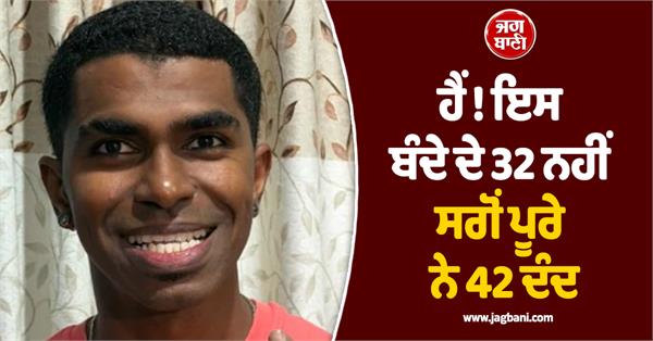 this man has not 32 but a full 42 teeth