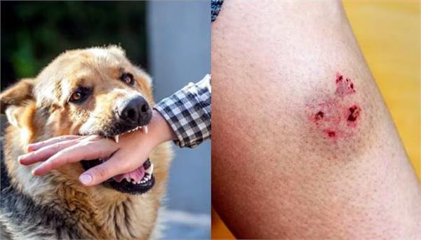 dog bite in satna
