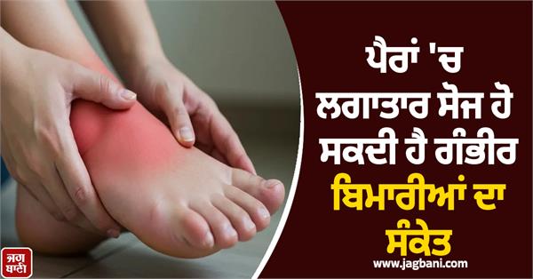 constant swelling in the feet can be a sign of serious diseases 