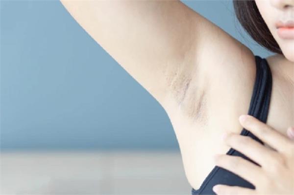 bothered by dark underarms try this home remedy