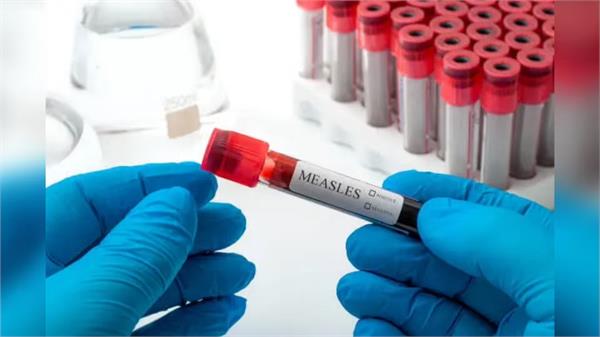 measles outbreak in bangladesh