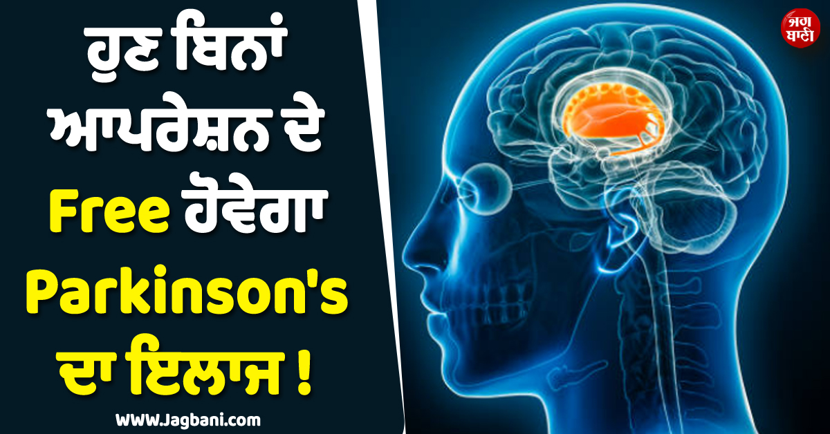 ਹੁਣ ਬਿਨਾਂ ਆਪਰੇਸ਼ਨ ਦੇ Free ਹੋਵੇਗਾ Parkinson''s ਦਾ ਇਲਾਜ ! AIIMS ਨੇ ਕੀਤਾ ਐਲਾਨ