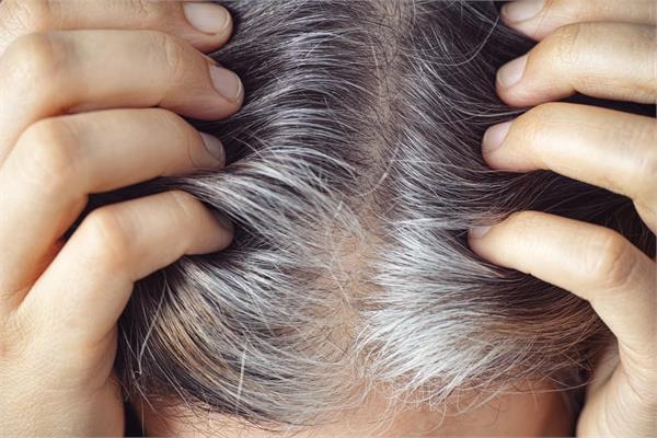 turn white hair black again with these home remedies