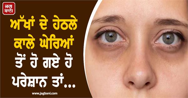 if you are troubled by dark circles