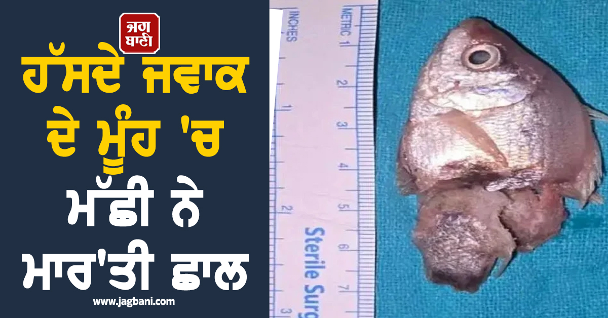 ਹੱਸਦੇ ਜਵਾਕ ਦੇ ਮੂੰਹ ''ਚ ਮੱਛੀ ਨੇ ਮਾਰ''ਤੀ ਛਾਲ, ਡਾਕਟਰਾਂ ਨੇ ਮਸਾਂ ਬਚਾਈ ਜਾਨ