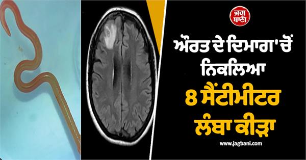 8 cm long worm found in woman  s brain