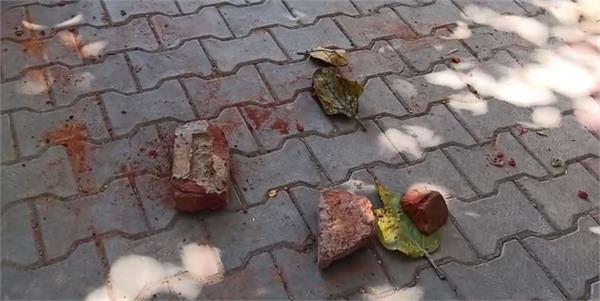 woman seriously injured after bullet hits ac  s dirty water