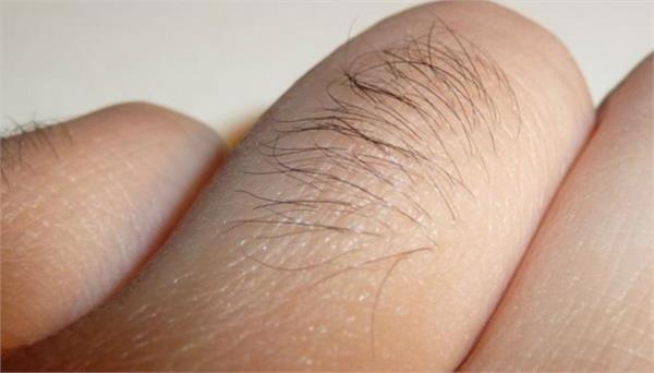 do you have hair on your fingers