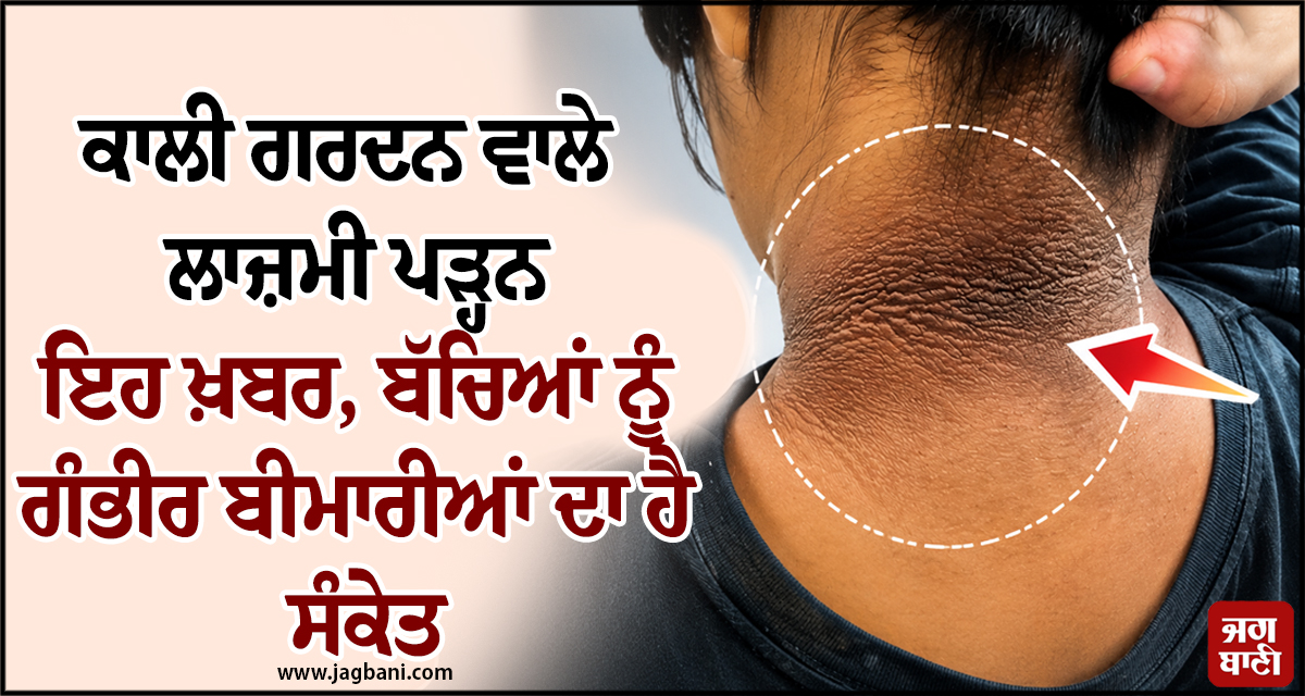 ਕਾਲੀ ਗਰਦਨ ਵਾਲੇ ਲਾਜ਼ਮੀ ਪੜ੍ਹਨ ਇਹ ਖ਼ਬਰ, ਬੱਚਿਆਂ ਨੂੰ ਗੰਭੀਰ ਬੀਮਾਰੀਆਂ ਦਾ ਹੈ ਸੰਕੇਤ